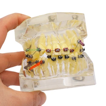 Стоматологическое Ортодонтическое лечение Модель зубов Модель коррекции неправильного прикуса с брекетами Цепная Проволока для изучения преподавания